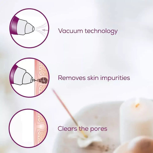 Beurer Pore Cleaner FC 41 — BambiniJO Jordan